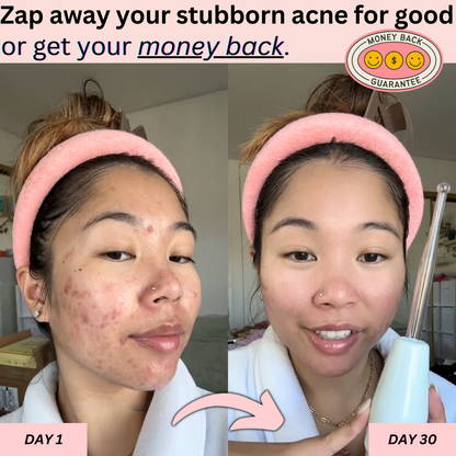 BeautyPro 2.0 - High Frequency Wand - Enjewl