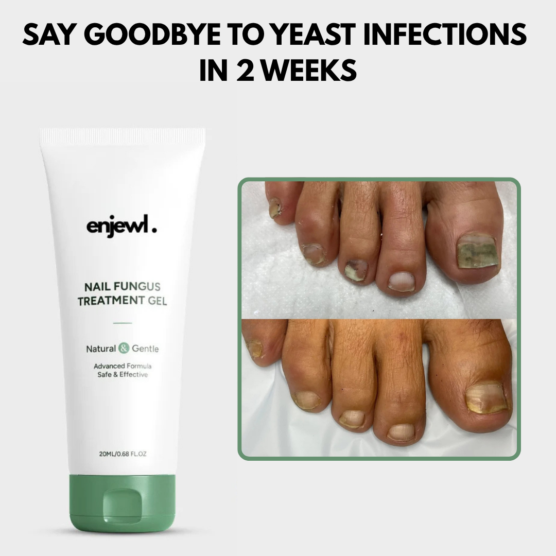 Nail Fungus Treatment Gel - Enjewl