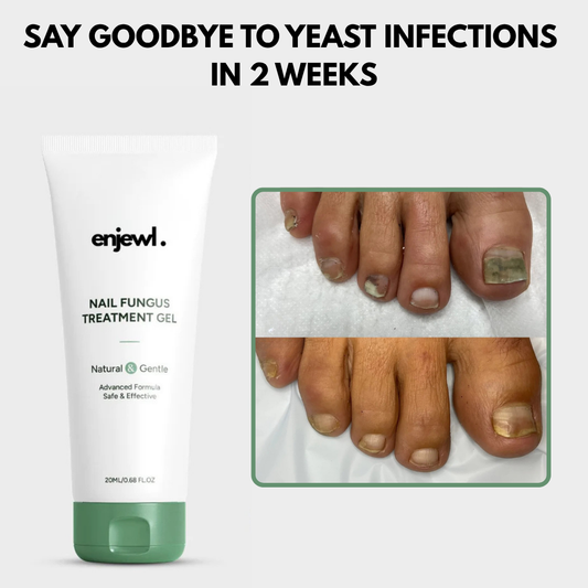 Nail Fungus Treatment Gel - Enjewl