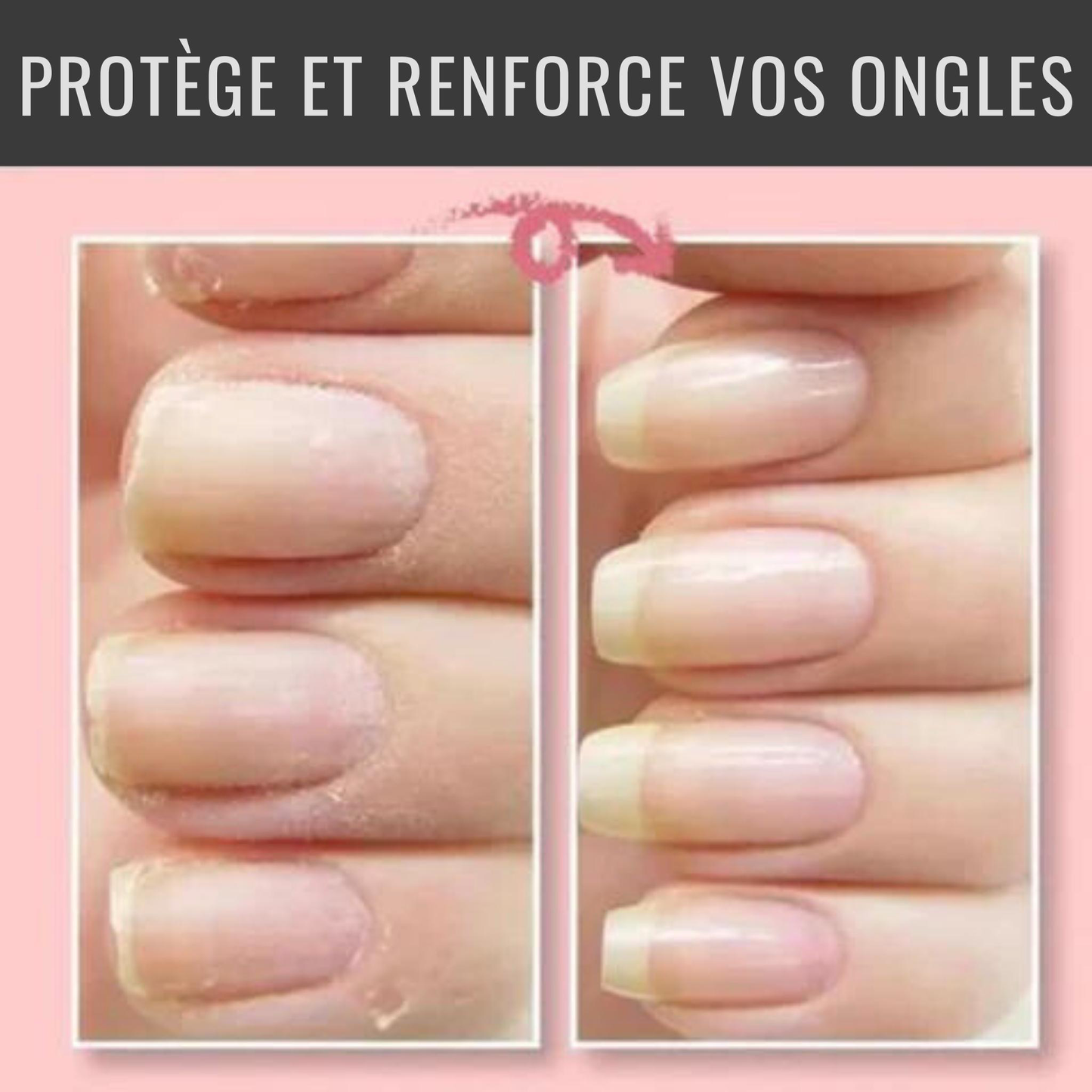 Gel Réparateur NailCare+™ | La Solution Miracle pour Ongles Cassés ou Fissurés