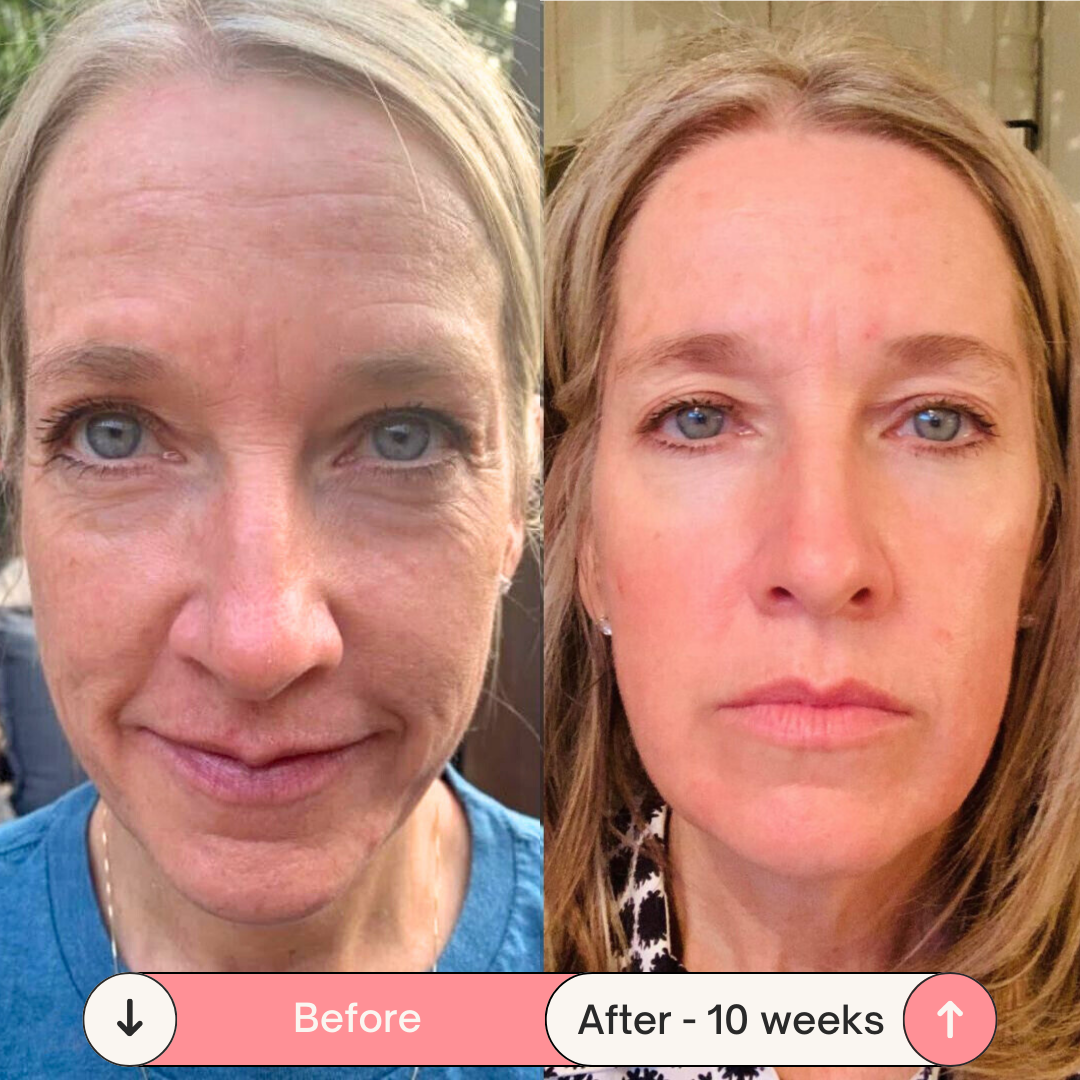 BeautyPro 2.0 - High Frequency Wand - Enjewl