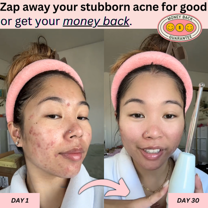 BeautyPro 2.0 - High Frequency Wand - Enjewl