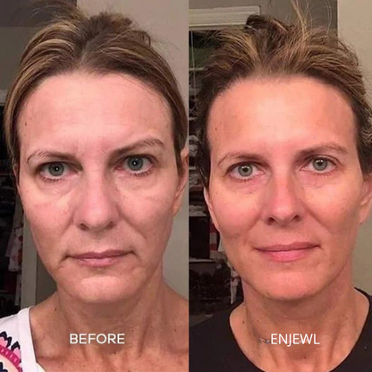 Enjewl™ | Clinical Beauty Filler - Enjewl