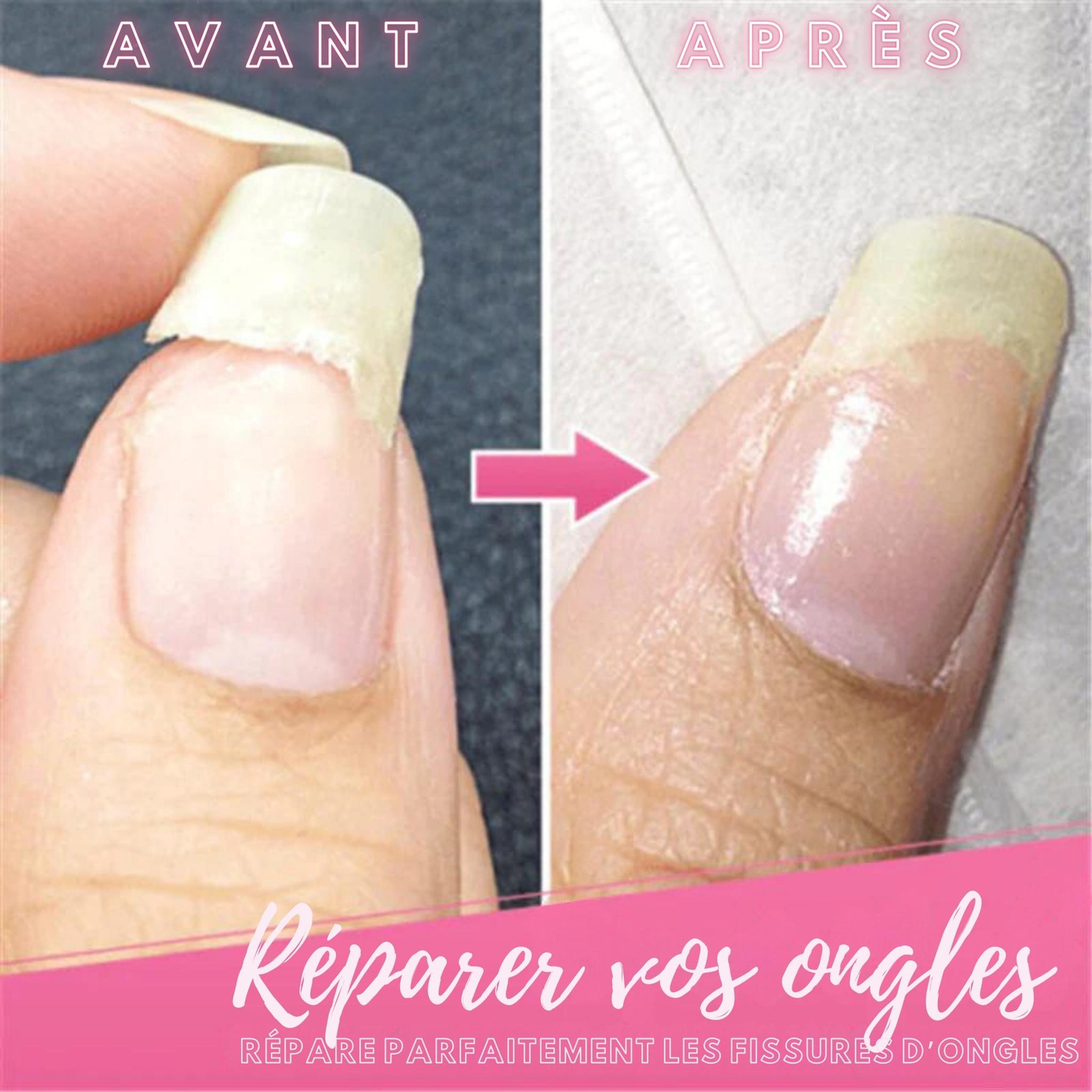 Gel Réparateur NailCare+™ | La Solution Miracle pour Ongles Cassés ou Fissurés