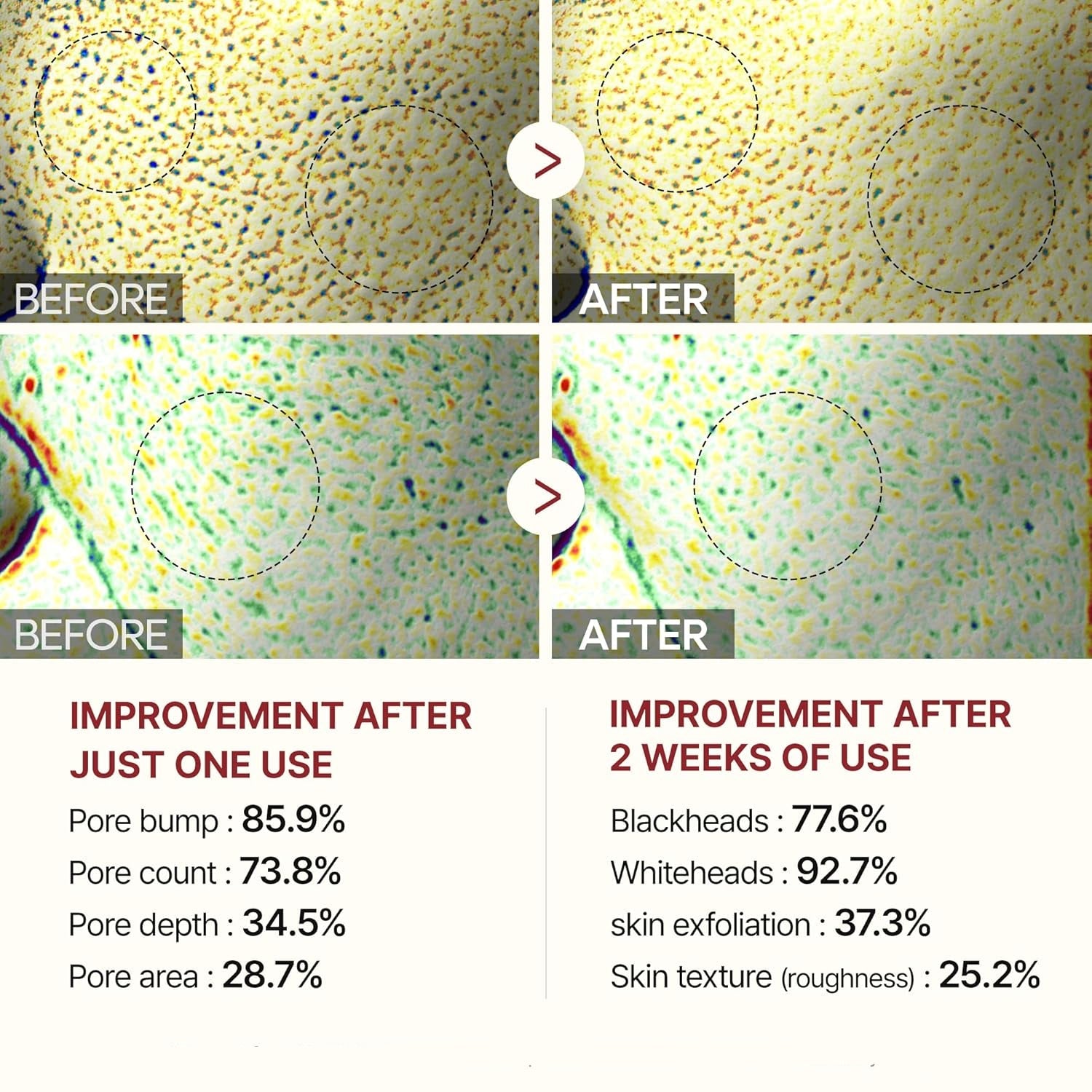 Glyssa Rice Peel Duo