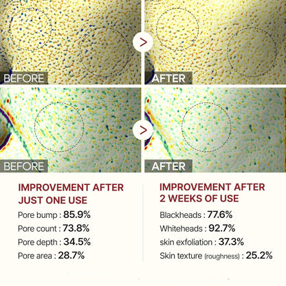 Glyssa Rice Peel Duo