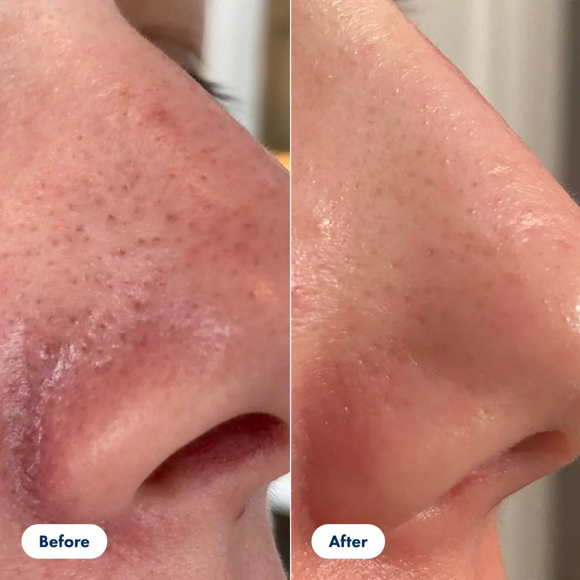 Glyssa Rice Peel Duo