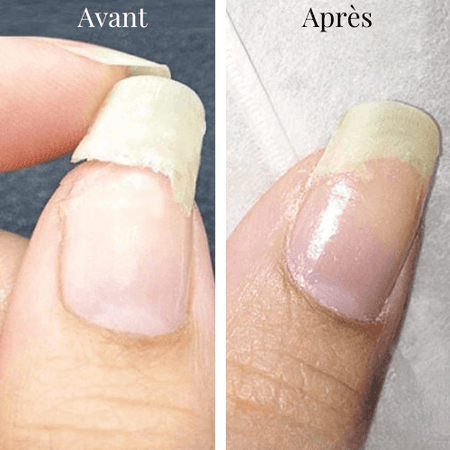 NailCare+ | Nail Repair Gel